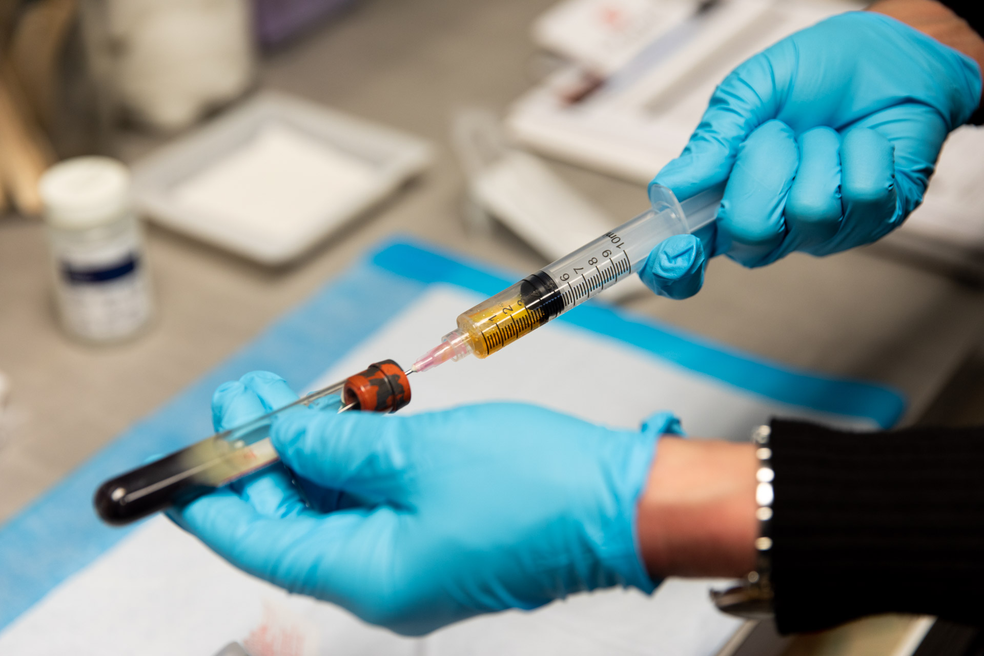 A health professional is prepping a syringe of PRP to treat hair loss in Denver