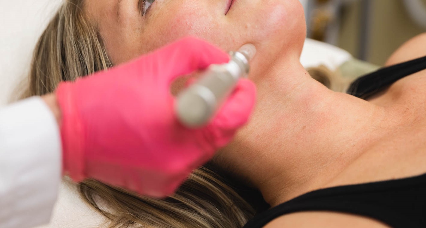 Close up of a woman recieving a skin rejuvenation treatment called microneedling in Denver