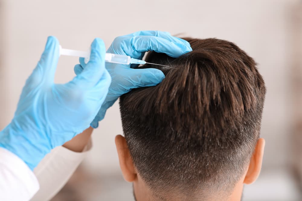 Close up of an injection for a hair loss treatment in Chicago